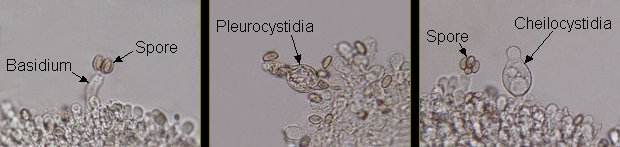 Cheilocystidia