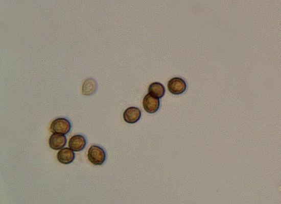 Cortinarius rotundisporus spores